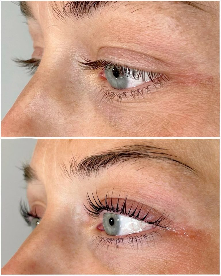 Glow on the move: Hydra Facial in Buckinghamshire that suits you