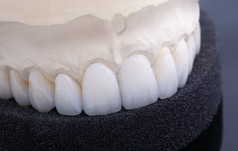 A local voice on Dental Lab Wichita, KS options