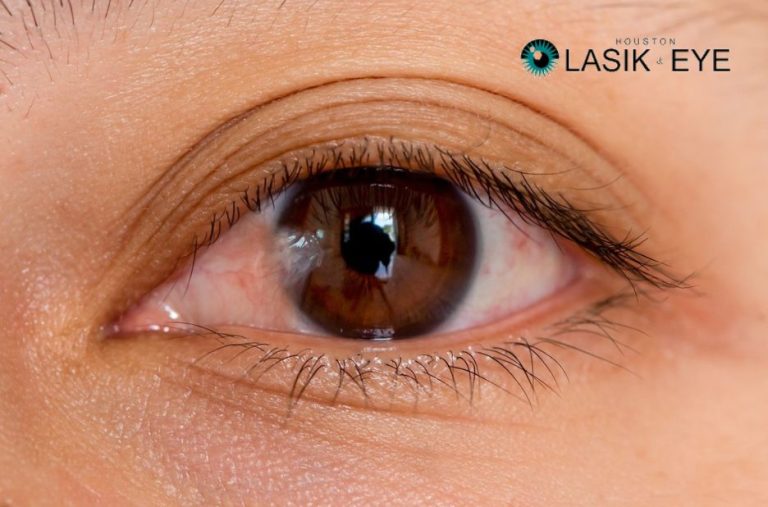 Practical guidance on pterygium management Practical guidance on pterygium management