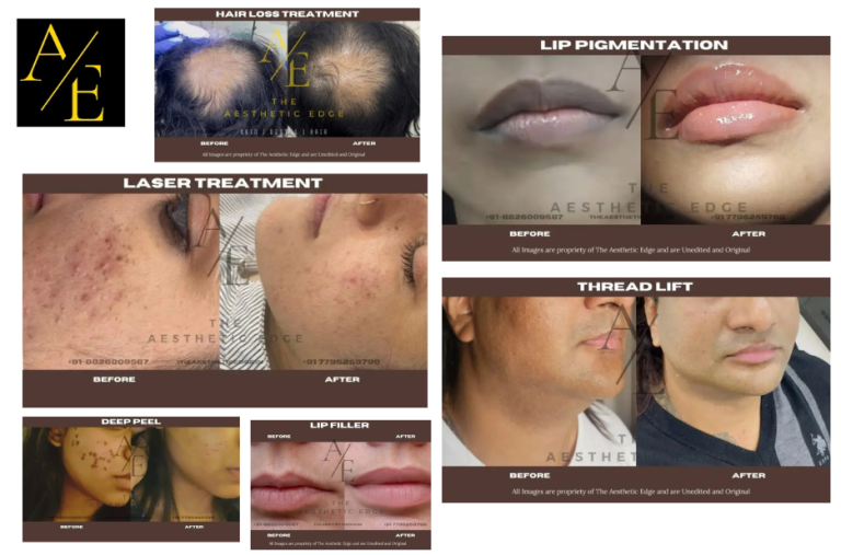 Safe and Effective Botox in Bangalore Clinics for Youthful, Natural Results