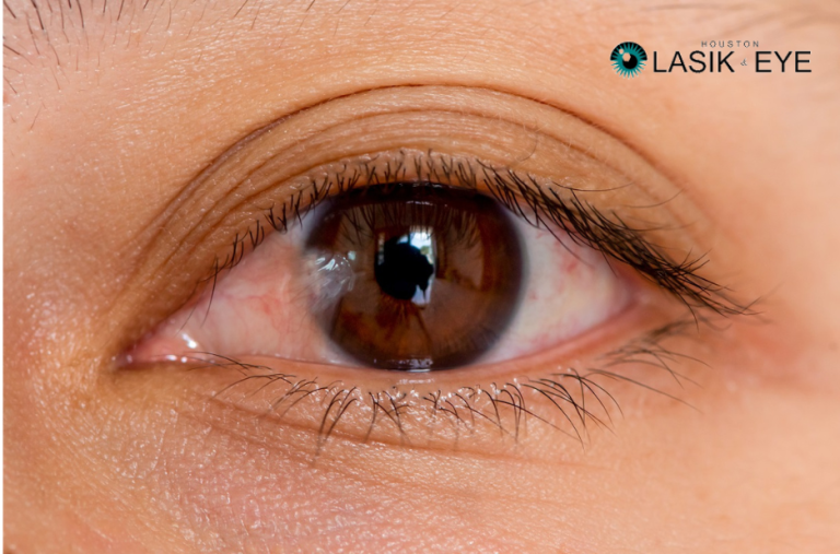 Effective Pterygium Eyedrops for Fast Relief and Comfort
