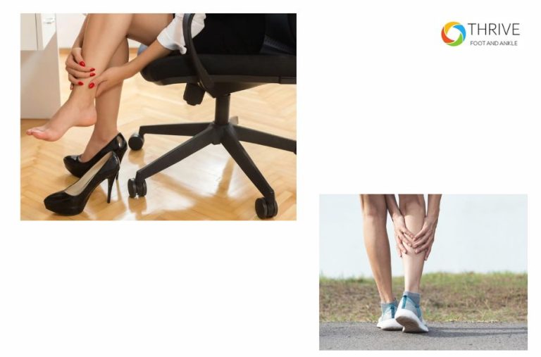 Relieving Heel Pain: A Practical Guide to Achilles Tendinopathy