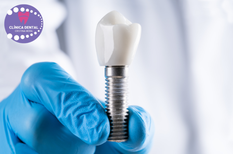 Especialistas en Ortodoncia Invisible en Bollullos Par del Condado – Clínica González Gayoso