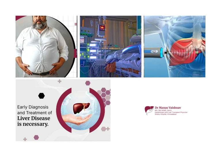 Trusted Liver Specialist in Ahmedabad for Comprehensive Liver and Gastrointestinal Care