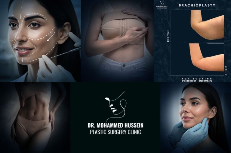 اكتشف أفضل دكتور تجميل في مصر للسعوديين مع الدكتور محمد حسين اكتشف أفضل دكتور تجميل في مصر للسعوديين مع الدكتور محمد حسين