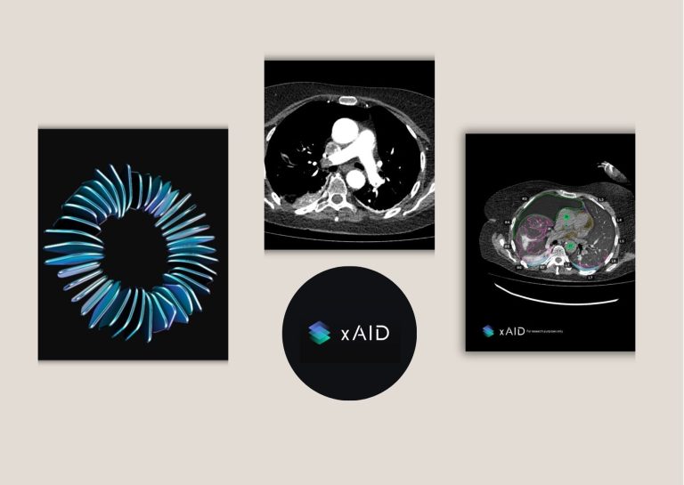How AI-Driven Radiology Workflows Reshape Reporting